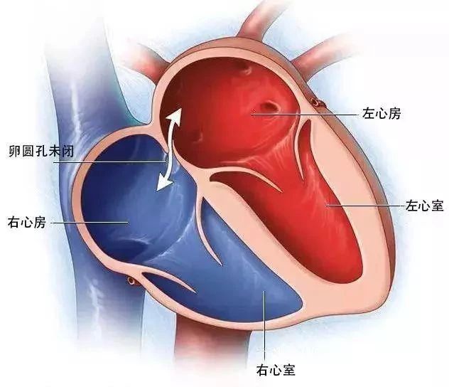 心脏缺电如何解决_心脏房缺心功能一级能进电网吗_心脏缺电是怎么回事