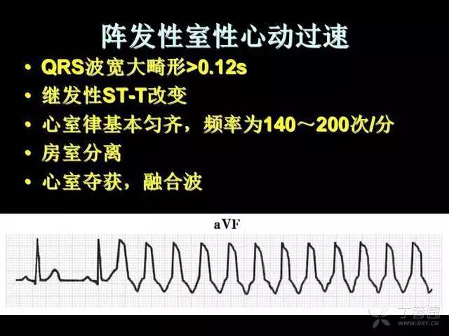 阵发性心房扑动的治疗_阵发性心房扑动吃什么药_阵发性室上性心动过扑