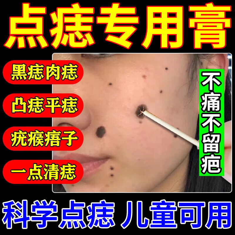 如何点过痣的地方快速好_如何点过痣的地方快速好_如何点过痣的地方快速好